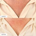 Kit 3 Adesivos Silicone Anti Rugas Colo e Peito – Efeito Lifting Enquanto Dorme Reduz Linhas de Expressão Reutilizável até 30x Alternativa Natural Muy Bela